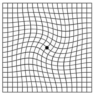 Distorted Amsler grid