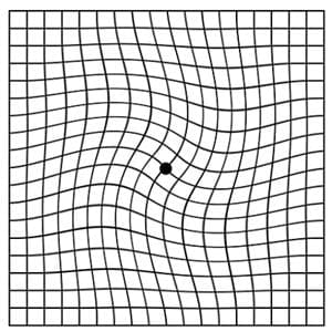 Distorted Amsler grid