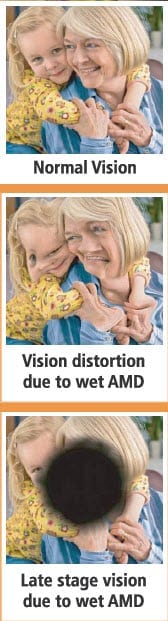 AMD