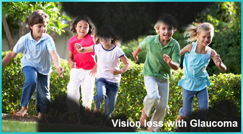 Vision Loss with Glaucoma