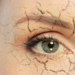 Dry_eyes