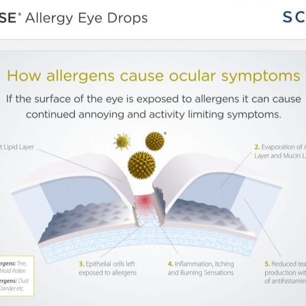 Optase_Allergy