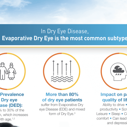 TheaLipid eye drops prevent evaporative dry eyes